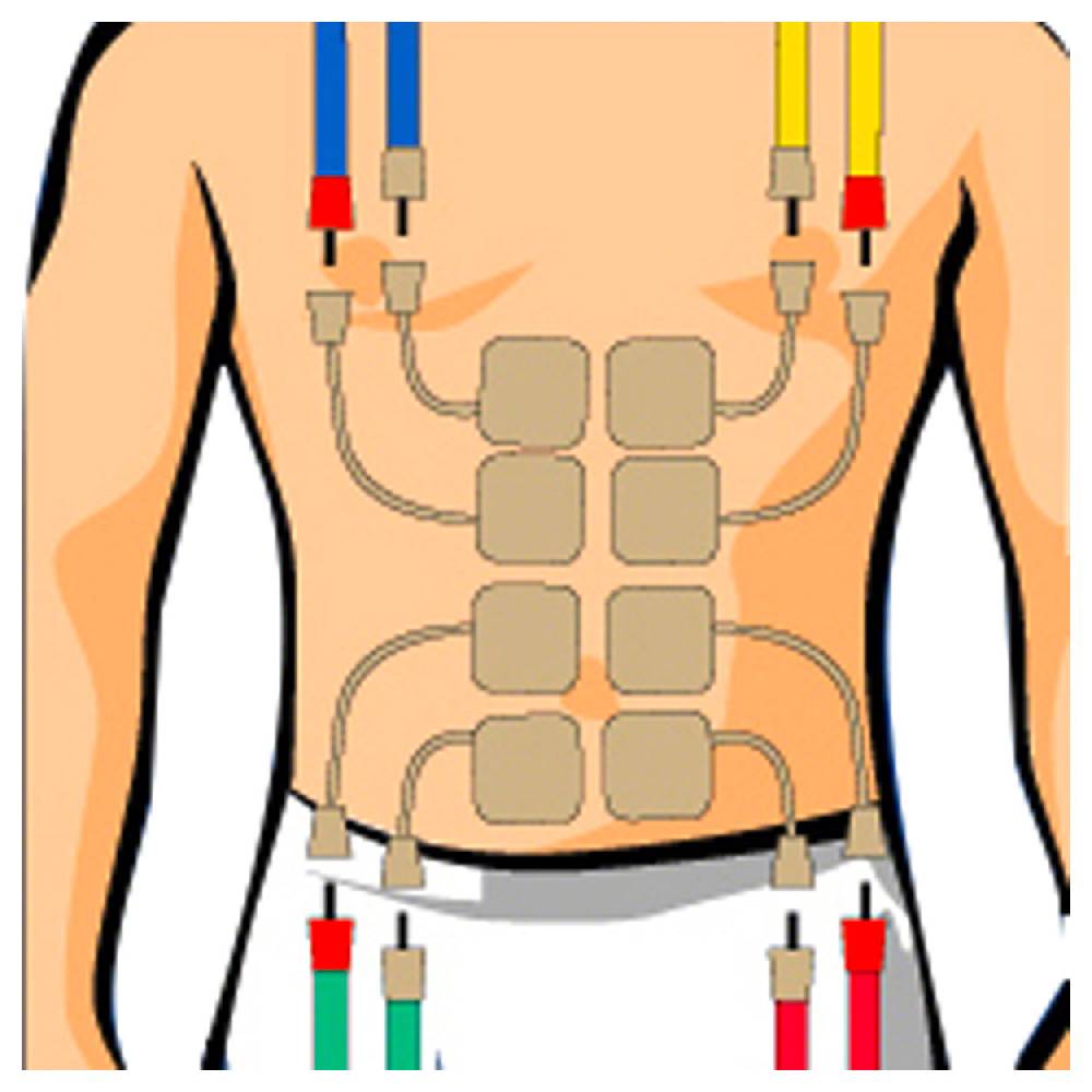 Sport Tec Compex Elektroden Wire, 5x5 cm, 4 Stück Flash Sale