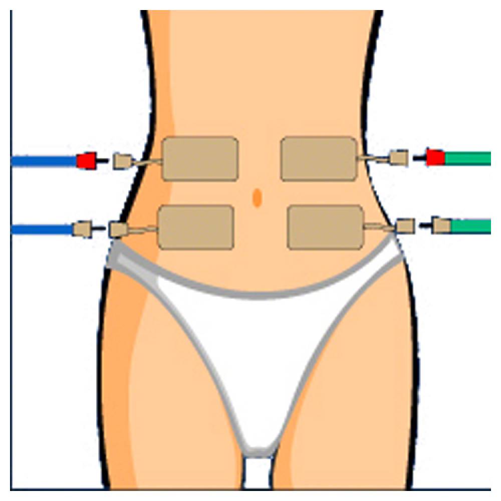 Sport Tec Compex Elektroden Wire, 5x10 cm, 2 Stück Begrenztes Angebot