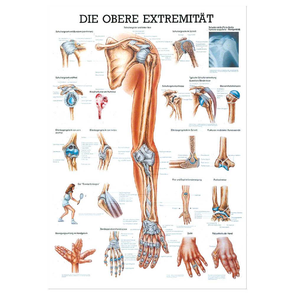 Sport Tec Mini-Poster "Obere Extremität", LxB 34x24 cm Neuheiten