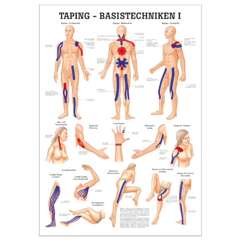 Sport Tec Lehrtafel "Taping- Basistechniken I", LxB 100x70 cm Fabrikpreis