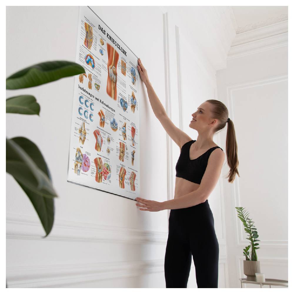 Sport Tec Lehrtafel "Das Kniegelenk", LxB 100x70 cm Tägliche Deals