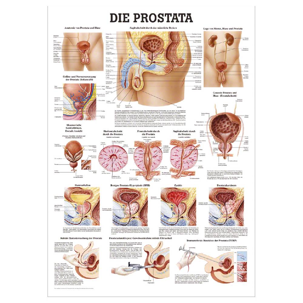 Sport Tec Lehrtafel "Die Prostata" LxB 100x70 cm Super Rabatt